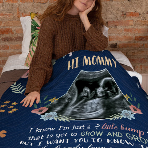 Mom To Be Gifts, Floral Printed With Baby's Sonogram Photo I Already Love You, Personalized Blanket, Gifts For New Mommy, Fleece Sherpa, New Mom Blanket For Mother's Day