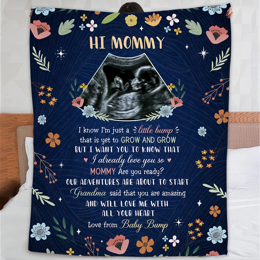 Mom To Be Gifts, Floral Printed With Baby's Sonogram Photo I Already Love You, Personalized Blanket, Gifts For New Mommy, Fleece Sherpa, New Mom Blanket For Mother's Day