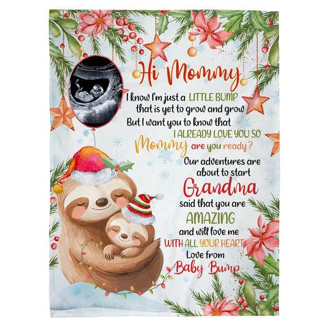 Personalized Sloth Pregnancy Announcement Fleece Sherpa Blanket, Ultrasound Baby Bump Gifts For New Mom New Dad, Meaningful Baby Reveal Keepsake, Expecting Parents Christmas Presents
