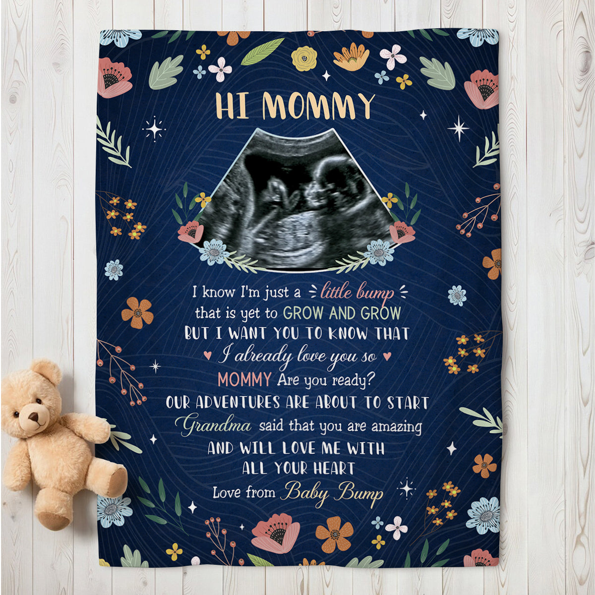 Mom To Be Gifts, Floral Printed With Baby's Sonogram Photo I Already Love You, Personalized Blanket, Gifts For New Mommy, Fleece Sherpa, New Mom Blanket For Mother's Day