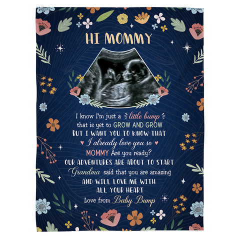 Mom To Be Gifts, Floral Printed With Baby's Sonogram Photo I Already Love You, Personalized Blanket, Gifts For New Mommy, Fleece Sherpa, New Mom Blanket For Mother's Day