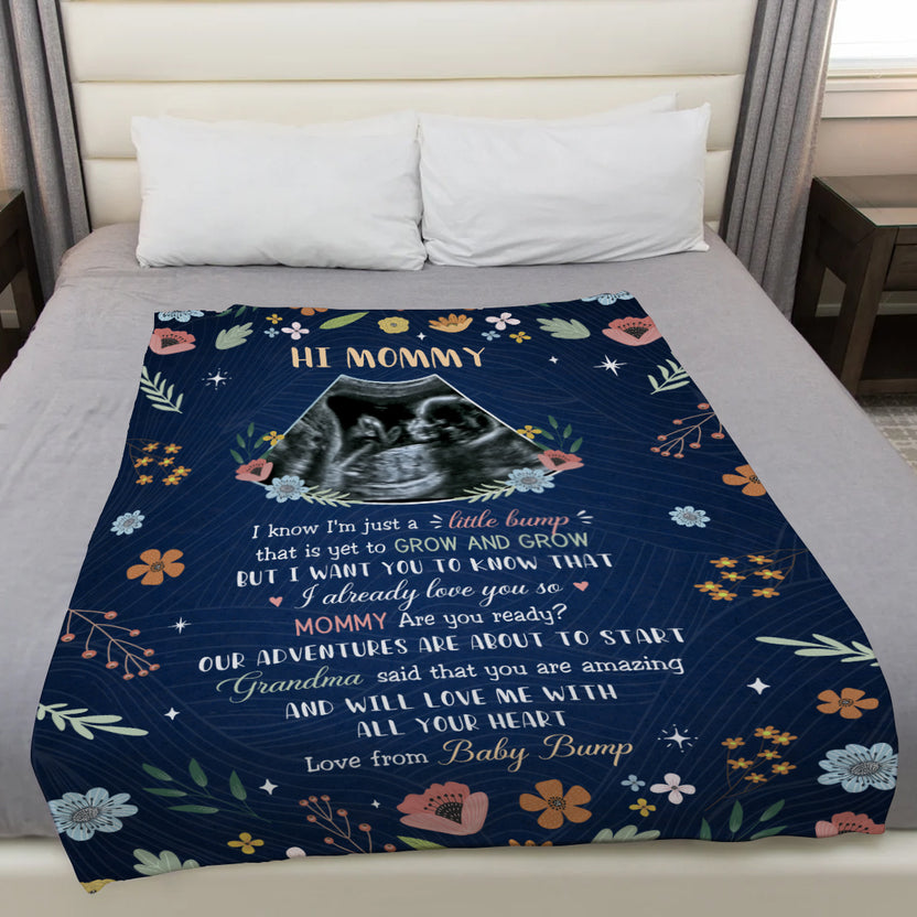 Mom To Be Gifts, Floral Printed With Baby's Sonogram Photo I Already Love You, Personalized Blanket, Gifts For New Mommy, Fleece Sherpa, New Mom Blanket For Mother's Day